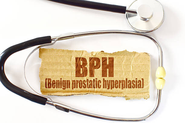 How Effective Is Non-Surgical Enlarged Prostate Treatment for BPH?